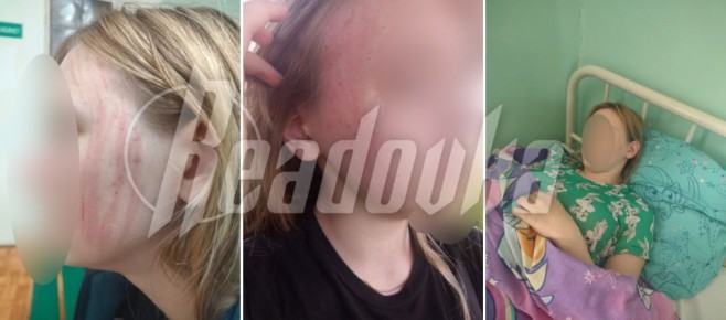 Во Ржеве водитель автобуса избил 14-летнюю девочку из-за того, что она не смогла доказать оплату проезда из-за проблем с интернетом