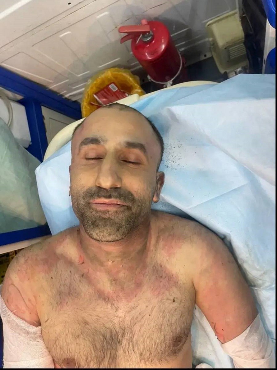 УМВД России по Тверской области просит помощи жителей региона в опознании мужчины, находящегося без сознания