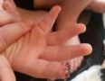 Мама рассказала, как сын остался без части пальца в Детском саду в Западной Двине